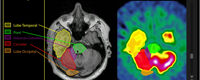 Neuroanatomie