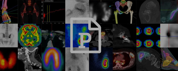Intérêt de l’imagerie SPECT pulmonaire pour la planification de la chirurgie et de la radiothérapie.