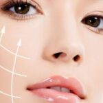 Illustration du profil de thermage flx