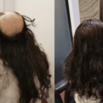 Illustration du profil de Hair Replacement Singapore